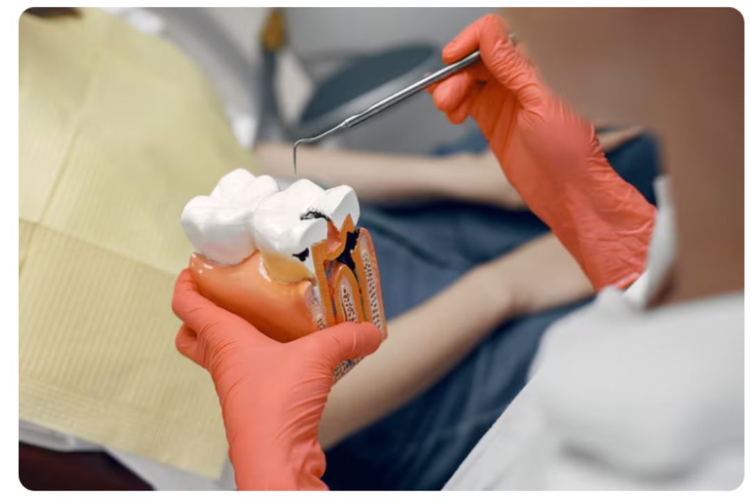 one tooth fixing cost in india affordable dental treatment expenses